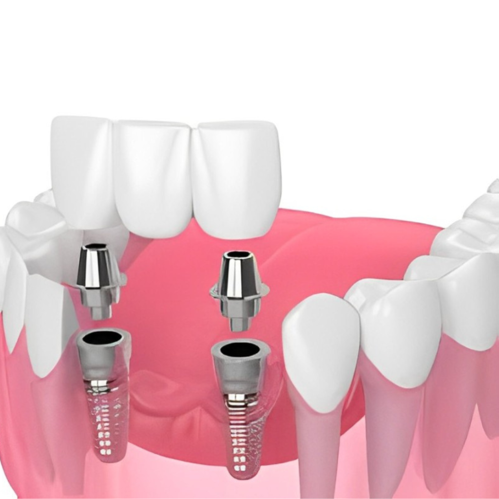 dentist in kandivali east