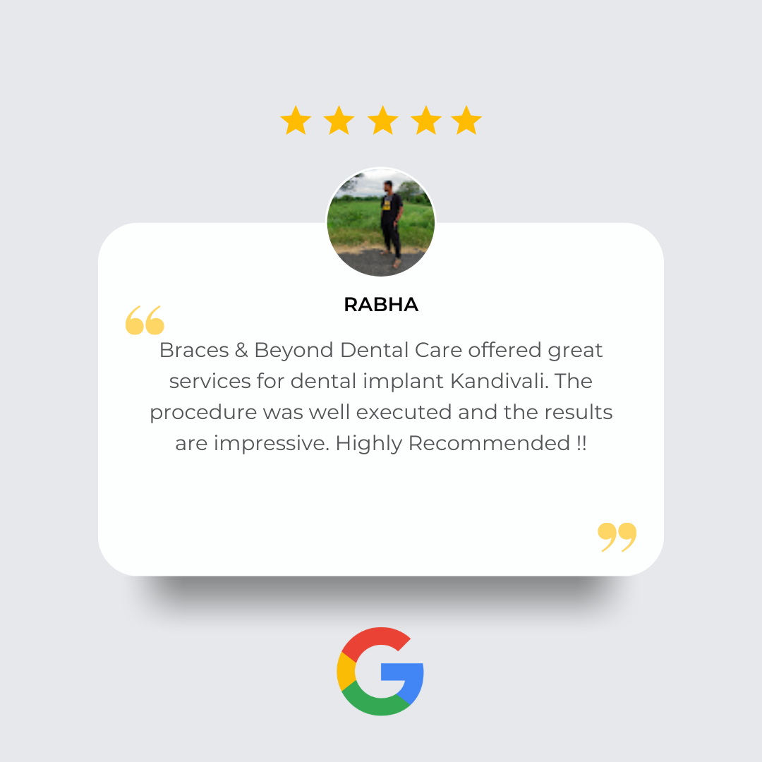 dentist in kandivali east - brace and beyond